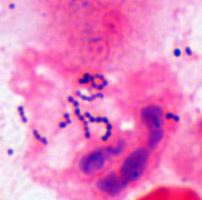 Метаболиты стрептококка провоцируют рак желудка