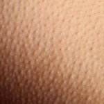 Мурашки по телу Мурашки по телу