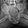 Рентген костей таза ребенку