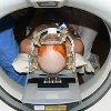 Стереотаксическая радиохирургия опухолей головного мозга