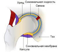 Синовит тазобедренного сустава у детей