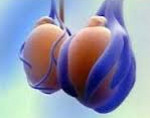 Гипоплазия яичек