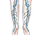 Болезни вен и лимфоузлов