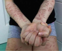 Příčiny autoagrese u dospělých: definice v psychologii, faktory, léčba