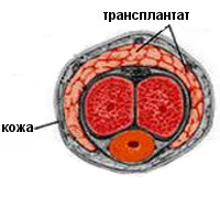 Головки полового члена (64 фото)