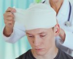 Скальпированная рана Скальпированная рана