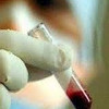 Анализ крови на плацентарный лактоген
