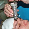 Трепанопункция лобной пазухи