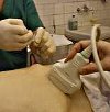 Эндоскопическое дренирование кисты поджелудочной железы