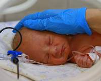 Кровоизлияние в надпочечники у новорожденных