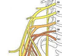 Плексит плечевого нерва лечение