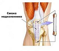 Процедура Пластика связок коленного сустава