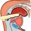 Пальцевое исследование прямой кишки