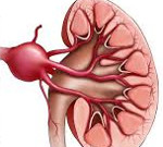 Аневризма почечной артерии