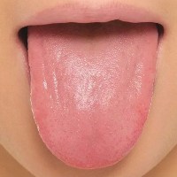 Микрофлора языка поможет выявить сердечную недостаточность Микрофлора языка поможет выявить сердечную недостаточность