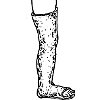 Наложение гипсовой повязки до коленного сустава