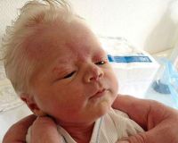 Генодерматозы