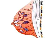 Эктазия протоков молочных желез