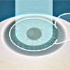 Лазерная коррекция зрения Super LASIK