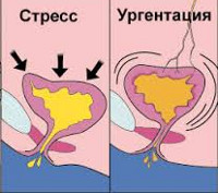 Недержание стула у детей