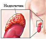 Адреногенитальный синдром