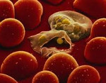 Малярия – диагностика, как передается? Симптомы и лечение малярии. Малярия