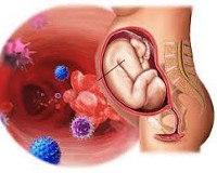 Цитомегаловирусная инфекция у беременных