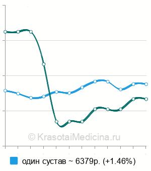 Средняя стоимость МРТ лучезапястного сустава в Москве