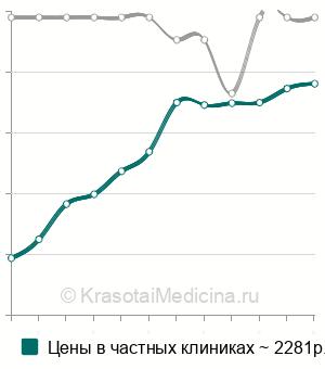 Средняя стоимость анализ на антитела к базальной мембране кожи (АБМ) в Москве