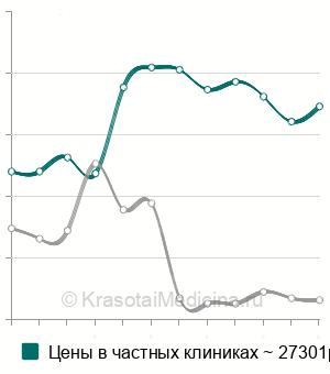 Средняя стоимость лаваж сустава в Москве