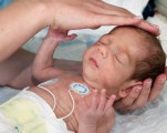Транзиторная ишемия миокарда у новорожденных