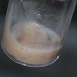 Зловонная мокрота Зловонная мокрота